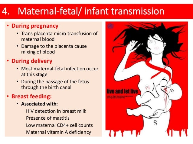 aids from breast milk Aids from breast milk
